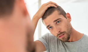 Best Hair Loss Clinic Preston