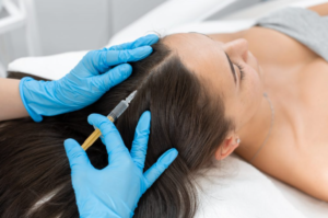Best Hair PRP Treatment Manchester