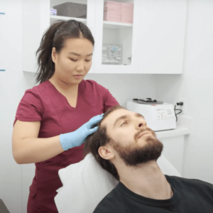 Best PRP For Hair Loss Devon