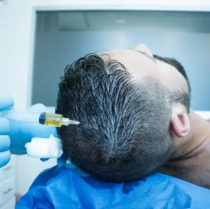 Best Oxford PRP Treatment for Hair Loss