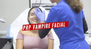 PRP Treatment for Face