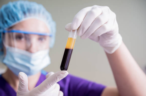 prp for hair growth